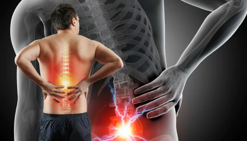 What is Sciatica? 25 Proven Tips to Relieve Sciatica Pain